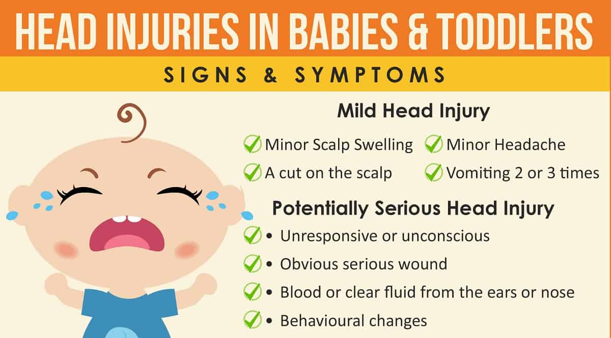 signs of head trauma in baby